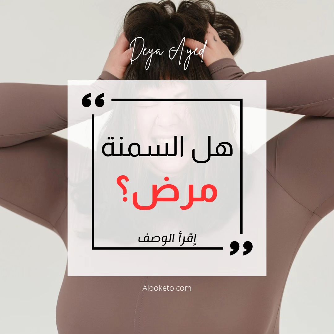 هل السمنة مرض؟