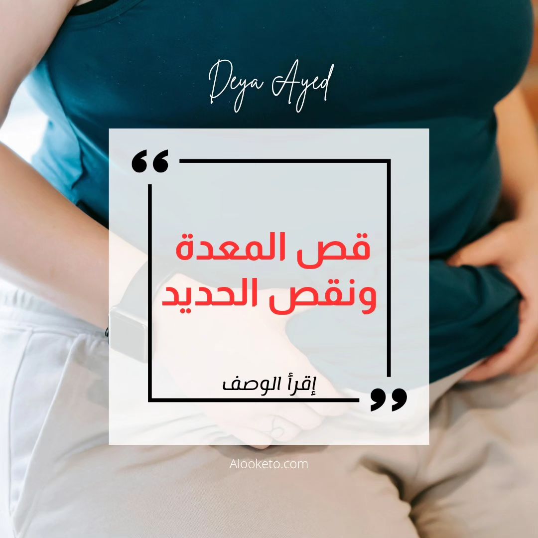 قص المعدة و نقص الحديد