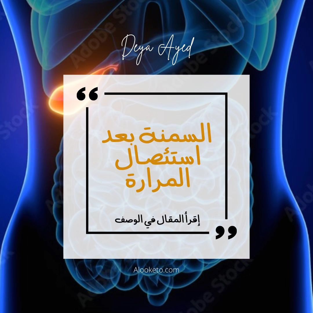 السمنة بعد استئصال المرارة