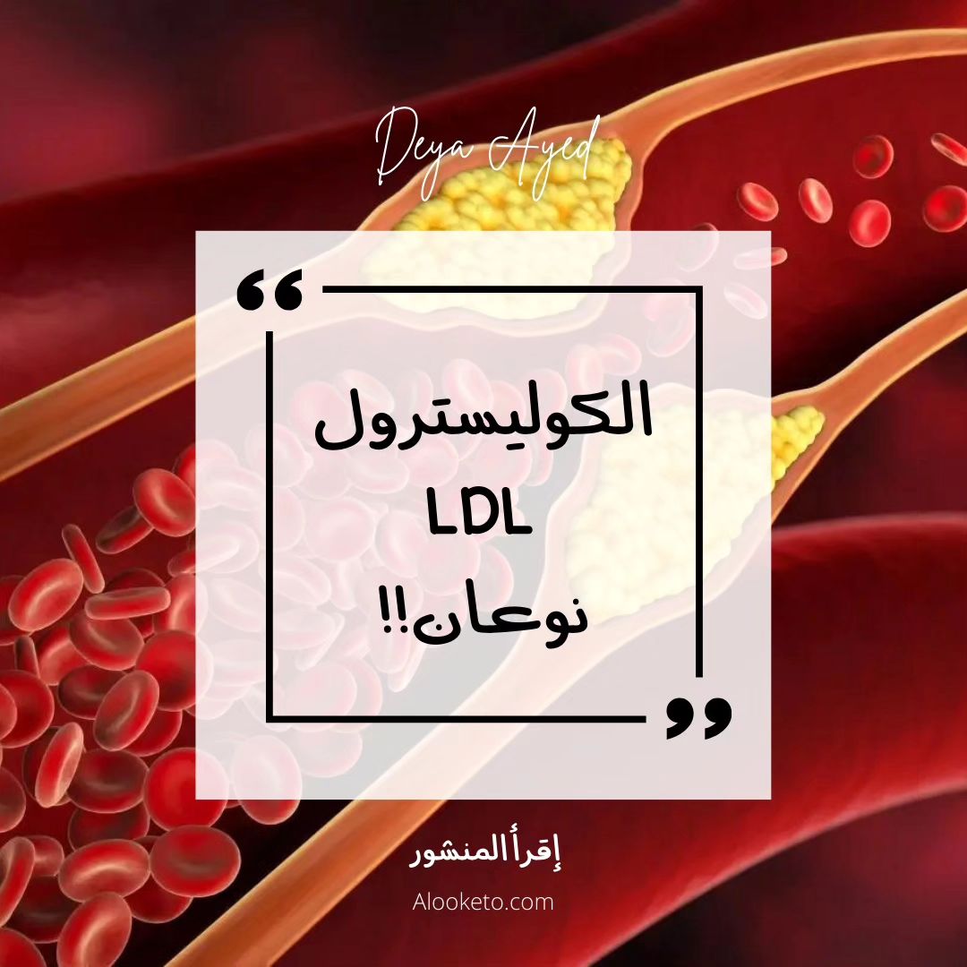 LDL نوعان