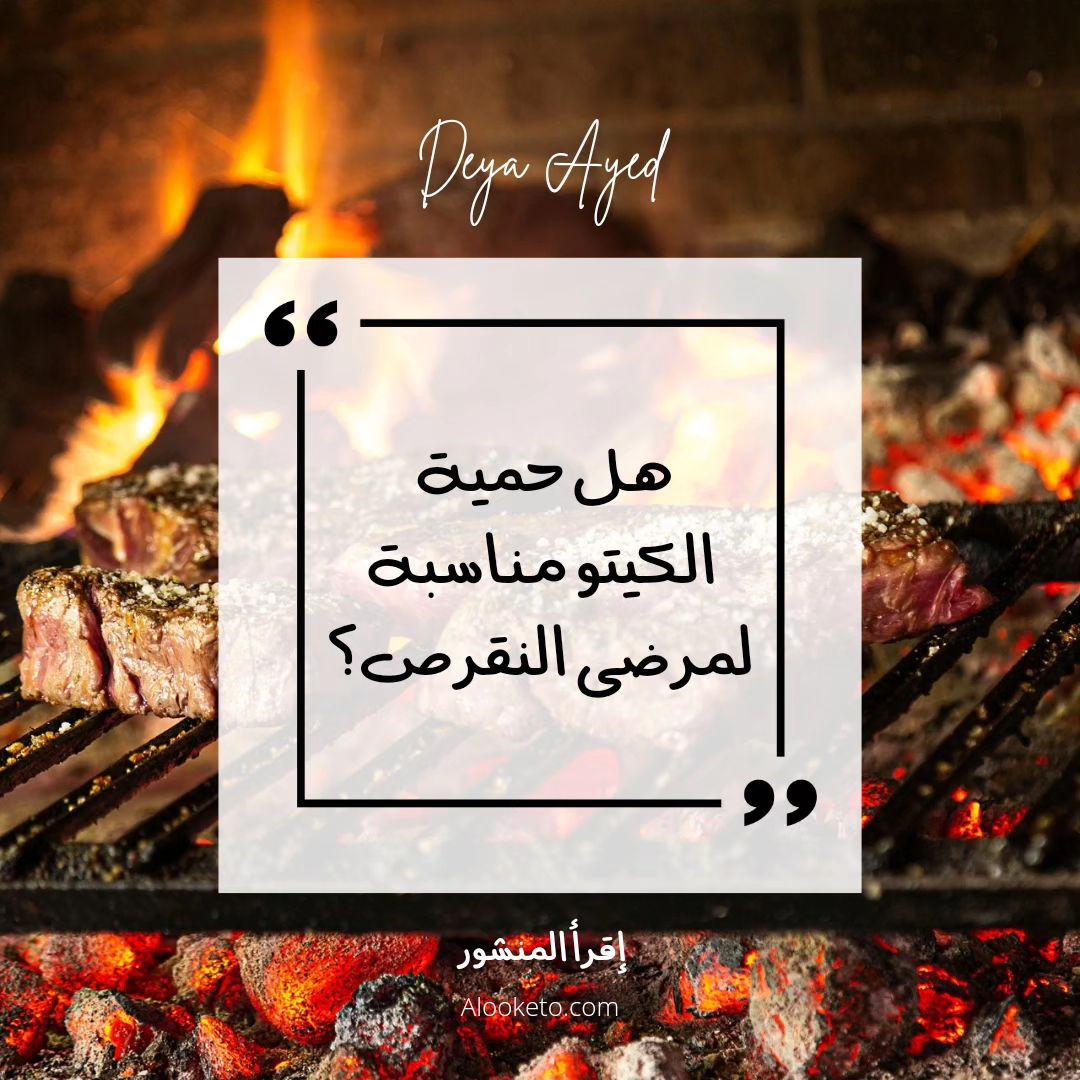 مرض النقرص و تطبيق حمية الكيتو