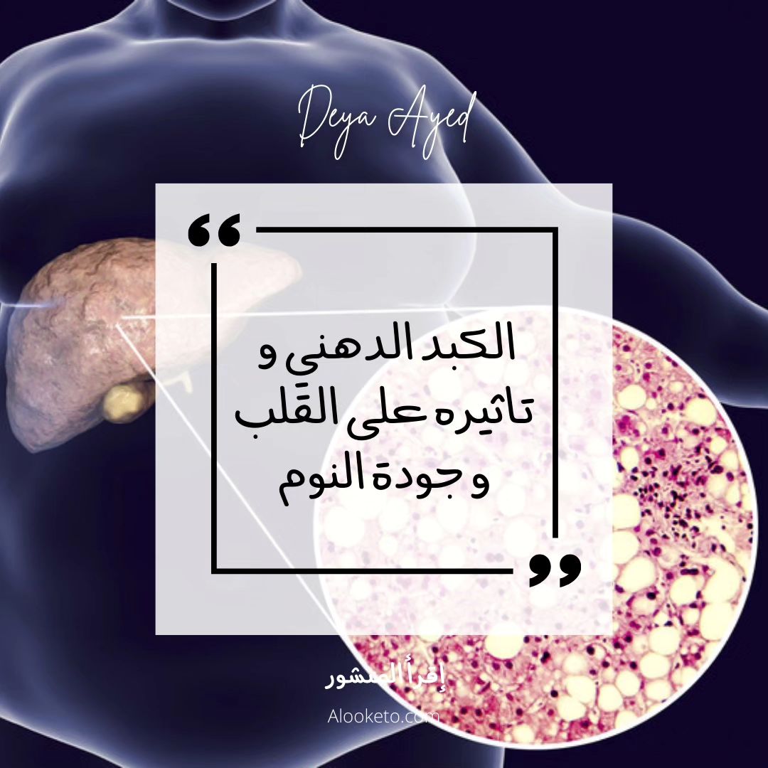 الكبد الدهني و تأثيره على القلب و جودة النوم